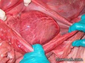 قلب انسان پس از مرگ چه شکلی است