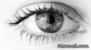 چشم ها از سلامت شما چه می گویند؟