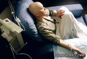 تشخیص زودهنگام سرطان مری