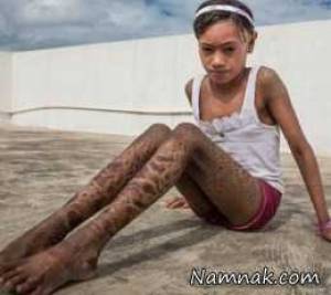 پوست بدن خواهر و برادر پوست ماری هر 10 روز یکبار عوض می شود: