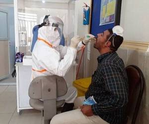 از لحاظ اپیدمیولوژیک شرایط مناسبی برای انجام تست PCR انبوه نداریم