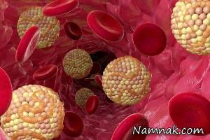 آشنایی با روش هایی برای افزایش کلسترول خوب خون