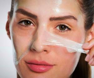 عوارض لایه برداری پوست صورت به شیوه های شیمیایی