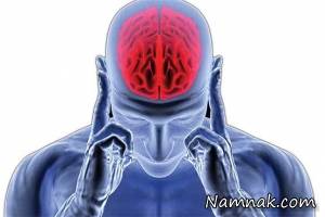 سکته مغزی چه علائمی دارد؟