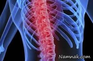 تازه ترین پژوهش های بعمل آمده درخصوص درمان بیماران نخاعی