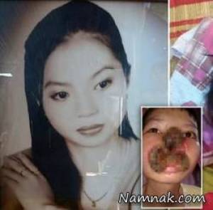 عفونت صورت چهره بازیگر زن زیبا را نابود شد