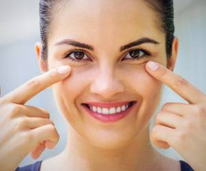 علت و درمان حلقه های تیره زیر چشم و به قولی کبودی زیر چشم