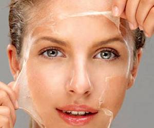 لایه برداری شیمیایی و تمام نکاتی که باید از قبل ، حین و بعد این روش پیلینگ بدانید