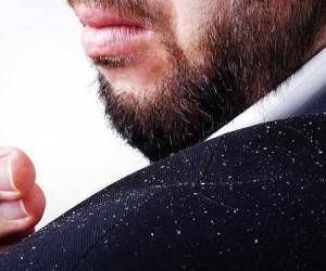 شامپو ضد شوره پروبیوتیک سریتا