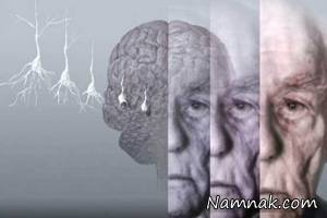 درمان آلزایمر با واکسن دی ان ای