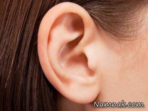 گوش طبیعی و بی نیاز از تیغ جراحان چه مشخصاتی باید داشته باشد