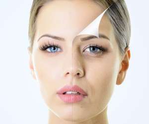 چگونه میتوانید تاثیر استرس را بر روی پوست خود کاهش دهید؟
