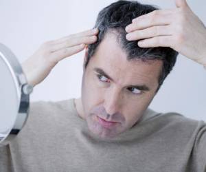 راه حل های ساده برای درمان ریزش موی شقیقه ها با نسخه های طب سنتی