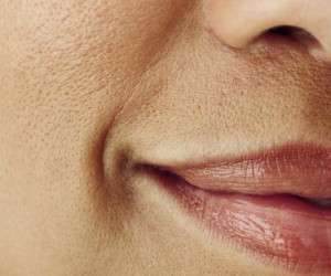بررسی علل پوست پرتقالی و درمان خانگی برای کاهش منافذ باز