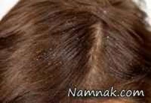 &nbsp;تاثیر شامپو بر روی موی سر مثبت یا منفی؟؟؟