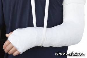 استخوان شکسته چگونه ترمیم می شود؟