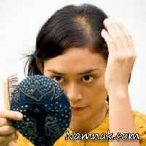 علت ریزش موی خانمها