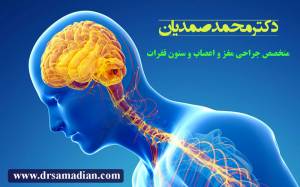رپورتاژآگهی :&nbsp;تومور های مغزی