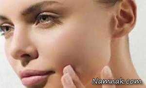 چگونه آکنه صورت را با تخم مرغ از بین ببریم