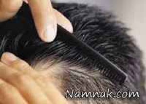 آشنایی با روشهای درمانی شوره سر