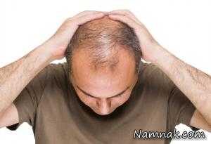 برای جلوگیری از ریزش مو مواد غذایی سرشار از آهن مصرف کنید
