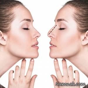 همه چیز درباره روش های باز و بسته جراحی بینی