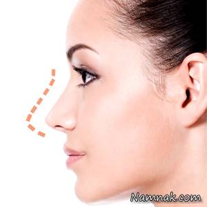 مهم ترین نکات در قبل و بعد از عمل بینی