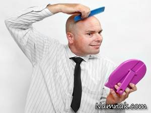 چیزهایی در مورد طاسی مردانه