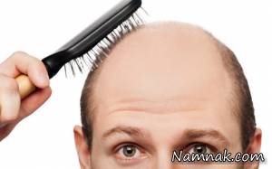 خطر طاسی زودرس در چه مردانی بیشتر است؟