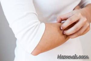 عوامل خشکی پوست در فصل پاییز