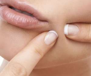 چگونه از شر جوش های زیر پوستی خلاص شویم؟
