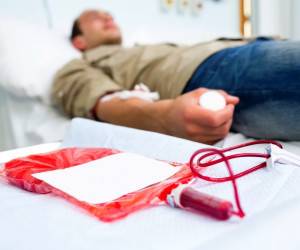 فصد خون و دلایل برتری آن نسبت به حجامت و بادکش