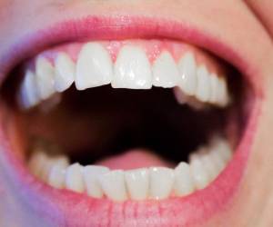 تغذیه لثه؛&nbsp;اگر لثه های سالم تر ی می خواهید، از این غذاها بیشتر بخورید&nbsp;