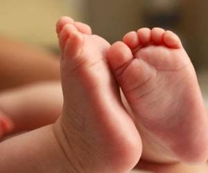 آیا کج شدن پا در نوزاد و کودکان نرمال است ؟