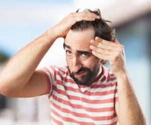 توصیه هایی برای کاهش و جلوگیری از ریزش مو در آقایان&nbsp;