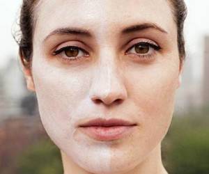کرم زینک اکساید چیست و چه کاربردی دارد ؟