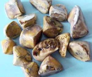 سیر تا پیاز آنچه باید در مورد سنگ کیسه صفرا بدانید