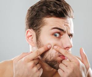 خوراکی ها و مواد غذایی که باعث جوش زدن میشوند
