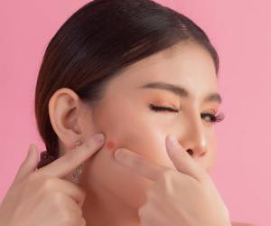 از علل تا راههای درمان خانگی جوش چرکی
