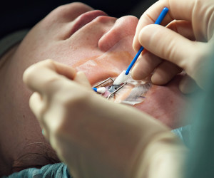 مشکلات و اصول مراقبت چشم پس از عمل لیزیک