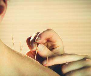 طب سوزنی و دیابت؛ هر آنچه باید بدانید