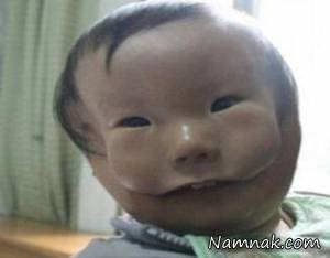 نقص مادرزادی این نوزاد چینی را معروف کرد