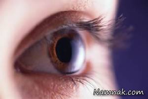 نقش مکمل های ویتامین در درمان سندرم خشکی چشم