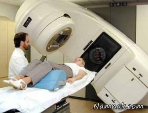 عوارض کم براکی تراپی برای بیماران سرطانی