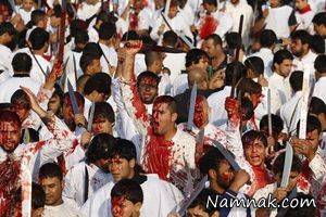 قمه زنی خطر ابتلا به فرسایش مغز را افزایش میدهد