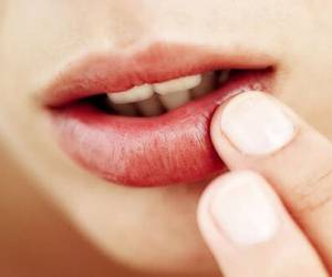رفع کبودی لب ، چگونه از شر کبودی لبها خلاص شویم؟