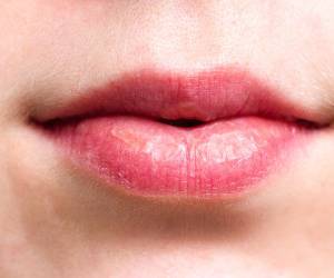 روش های جلوگیری و پیشگیری از ترک لبها
