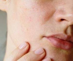 بهترین و طبیعی ترین راه برای پاکسازی منافذ باز پوست