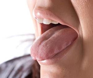 5 نشانه اولیه سرطان زبان