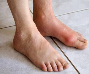 تشخیص سلامت داخلی بدن از روی ناخن و شکل پا